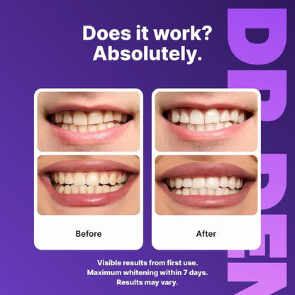Purple Whitening Strips™ | Remove Stains & Brighten Your Smile