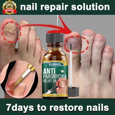 Anti Paronychia Relief Oil: Buy 1 Get 1 Free